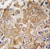 LECT1 / Chondromodulin-I Antibody (aa253-281)