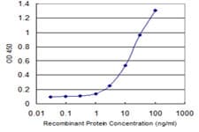 IHC-plus™ CAMK1D Antibody (clone 3H8)