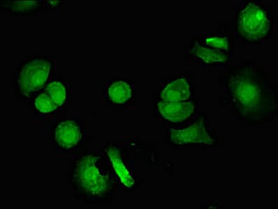 Polyclonal Rabbit anti-Human SKD1 / VPS4B Antibody (IHC, IF, WB)