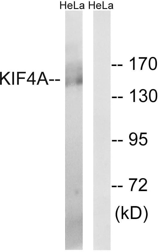 KIF4A Antibody (aa1171-1220)