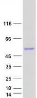 Human TNMD / Tenomodulin Protein (Recombinant Myc-DDK (Flag))