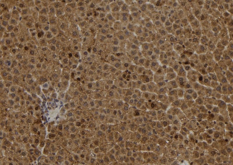 S100A2 Antibody