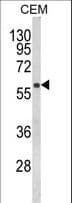 FLCN / Folliculin Antibody (aa325-354)
