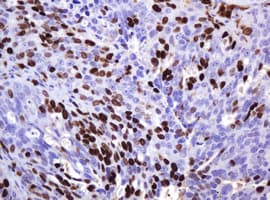 MKI67 / Ki67 Antibody (clone OTI9H7)