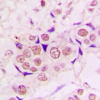 ZC3H8 Antibody (Internal)