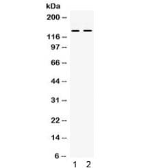 Polyclonal Rabbit anti-Human RENT1 / UPF1 Antibody (IHC, WB)