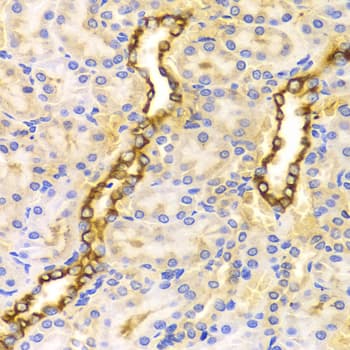 Polyclonal Rabbit anti-Human CPT2 Antibody (IHC, IF, WB)