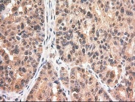 Monoclonal Mouse anti-Human MYC / c-Myc Antibody (clone OTI1A6, IHC, IF, WB)