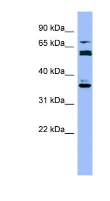CYP2B6 Antibody (aa215-264)