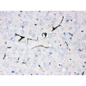 CP / Ceruloplasmin Antibody (aa20-258)