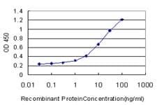 IHC-plus™ Monoclonal Mouse anti-Human SGK1 / SGK Antibody (clone 1C4, IHC, IF, WB)