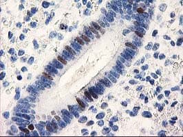 UNG / Uracil DNA Glycosylase Antibody (clone OTI1G2, Carrier-free)