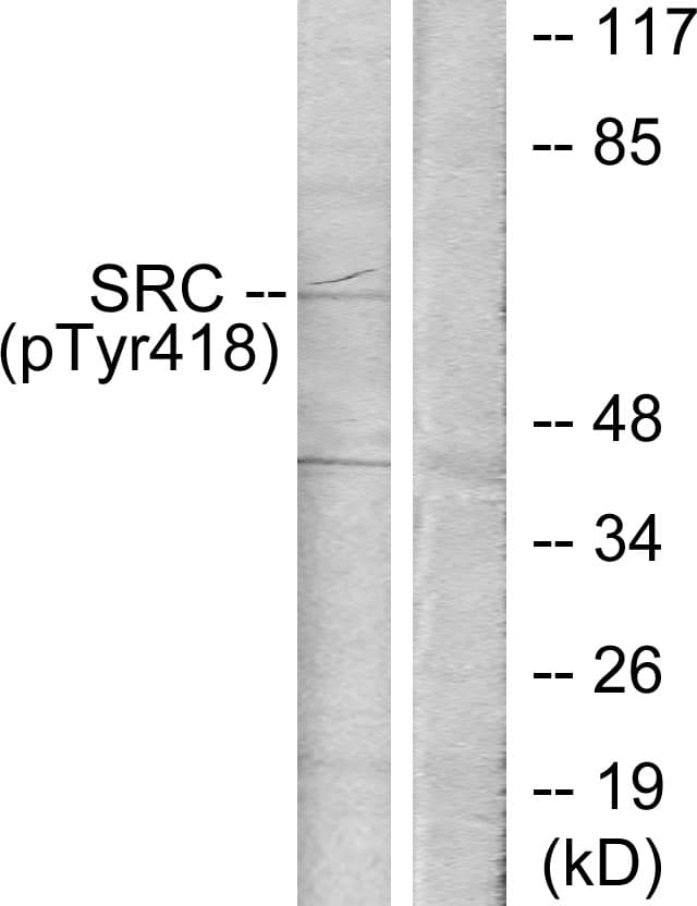 SRC Antibody (phospho-Tyr418)