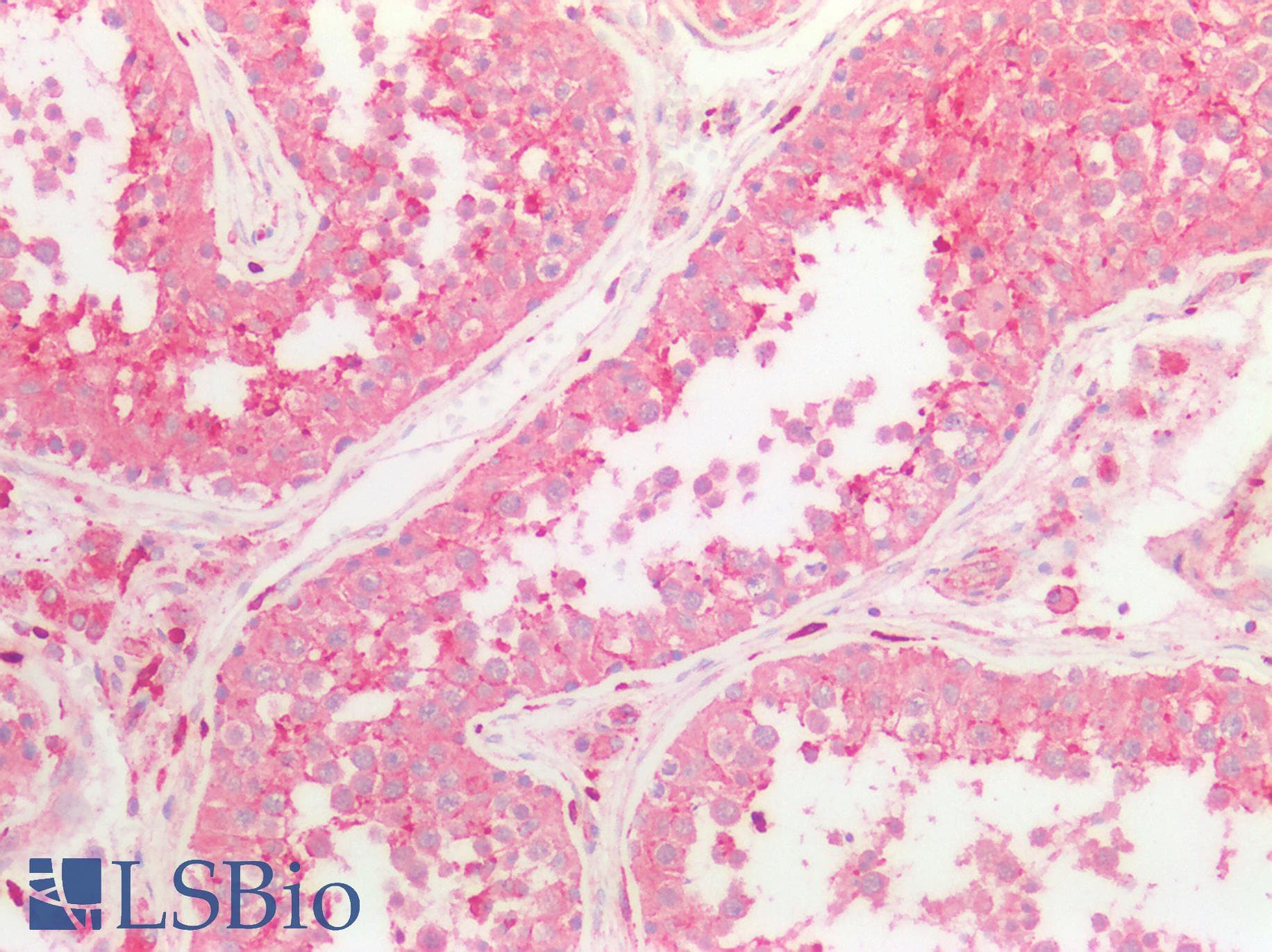 IHC-plus™ Polyclonal Rabbit anti-Human OPRL1 / ORL1 Antibody (IHC, WB)