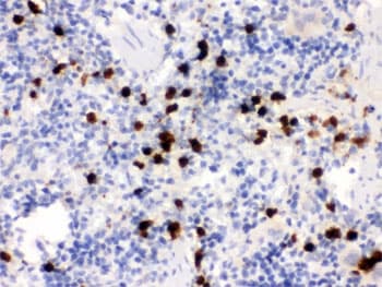 S100A9 / MRP14 Antibody