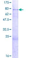 Human BTBD1 Protein (Recombinant GST)