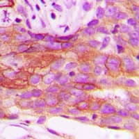 LIPE / HSL Antibody (Internal)