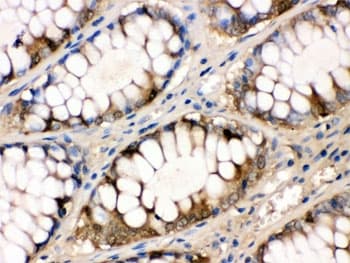 FABP1 / L-FABP Antibody