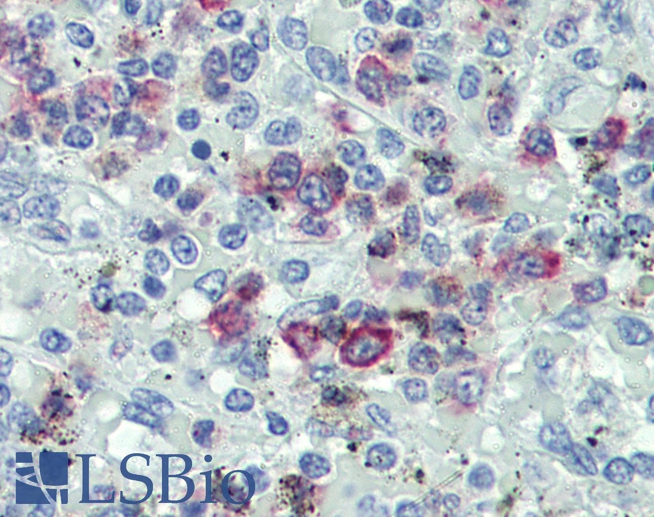 PathPlus™ FASLG / Fas Ligand Antibody