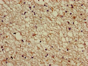 ABI2B / ABI2 Antibody