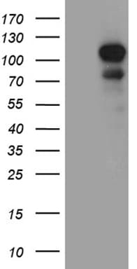 DLGAP3 / SAPAP3 Antibody (aa794-902, clone OTI1D3)