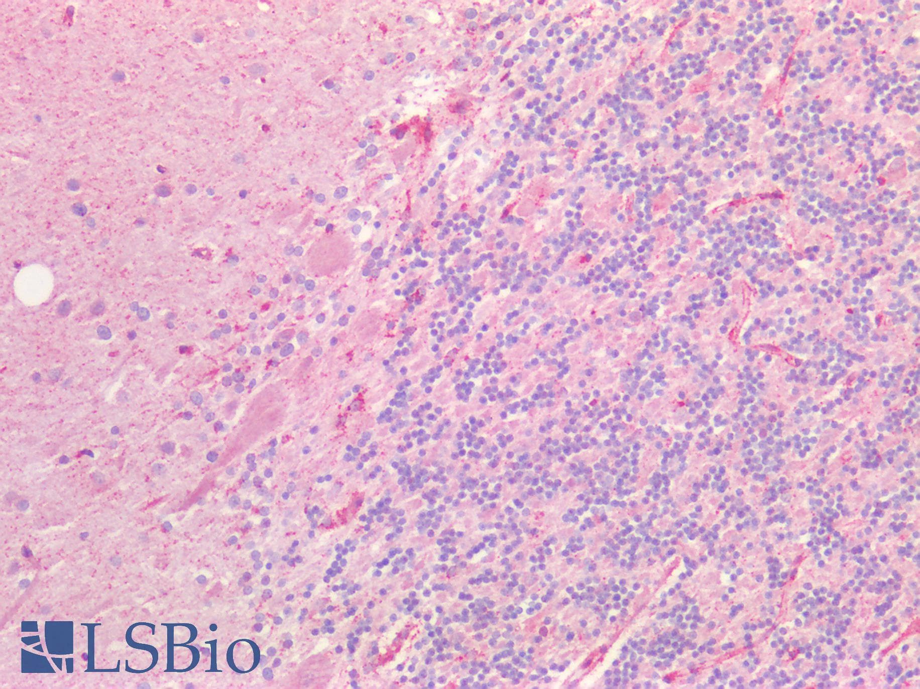 PathPlus™ EPHA4 / EPH Receptor A4 Antibody (aa40-70)