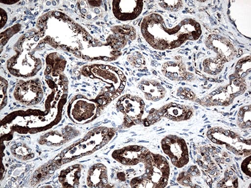 CTSL / Cathepsin L Antibody (aa114-333, clone OTI6D5, Carrier-free)