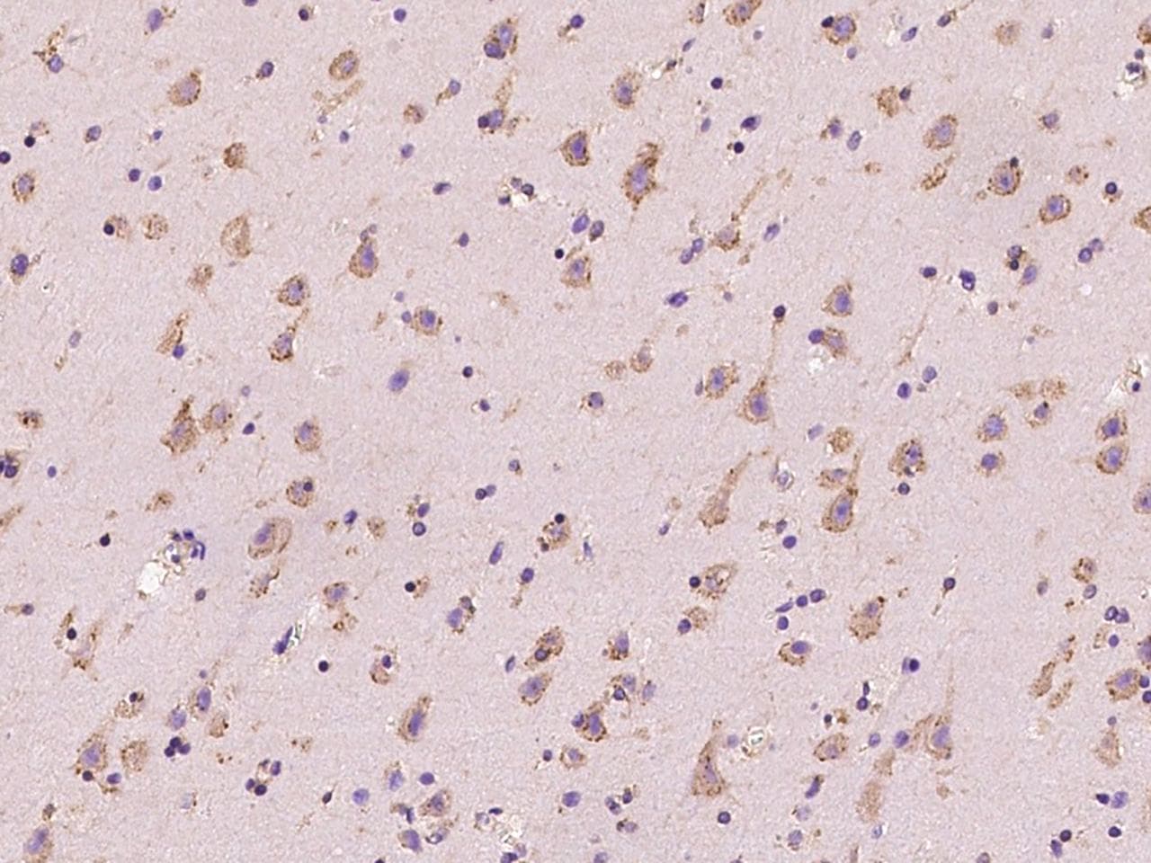 RAB5IF Antibody