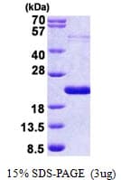 Human THRSP Protein (Recombinant His)