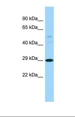 Polyclonal Rabbit anti-Human PTCD3 Antibody (aa97-146, WB)