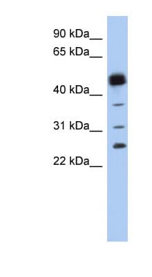 HPGDS Antibody (aa35-84)