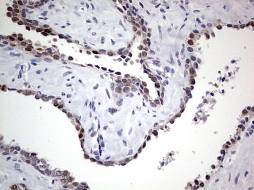 Monoclonal Mouse anti-Human RAD23B / HR23B Antibody (clone OTI7G10, aa1-253, IHC, WB)