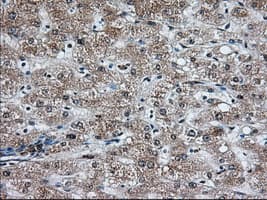 HMRF1L / MTRF1L Antibody (clone OTI2B5)