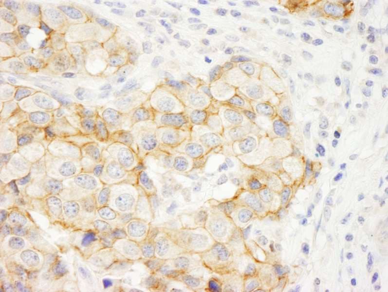 KIAA0528 Antibody (aa375-425)