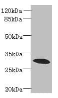 Polyclonal Rabbit anti-Human PDCL2 Antibody (IHC, WB)