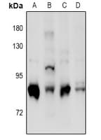Polyclonal Rabbit anti-Human PRKCD / PKC-Delta Antibody (WB)