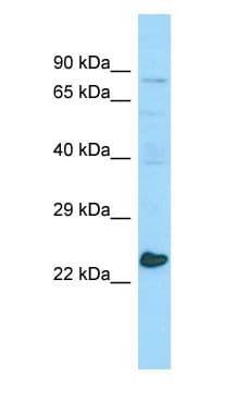 MED20 Antibody (aa83-132)
