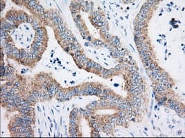 HIBCH Antibody (clone OTI3H5)