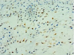 PDK2 Antibody (aa128-407)