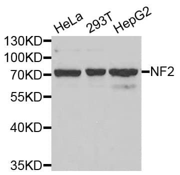NF2 / Merlin Antibody