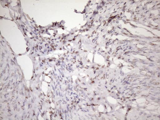 EXOSC1 / CSL4 Antibody (clone OTI4B7)