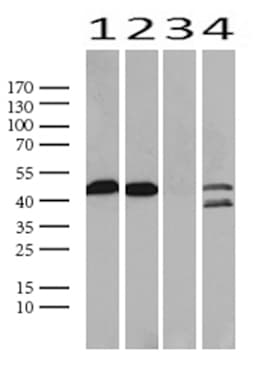 Monoclonal Mouse anti-Human TP53 / p53 Antibody (clone UMAB206, Carrier-free, IHC, IF, WB)