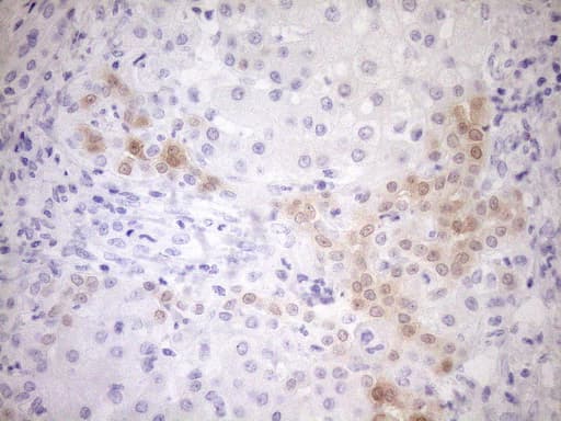 p16INK4a / CDKN2A Antibody (clone OTI7B10)