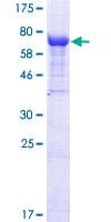 Human ISG54 / IFIT2 Protein (Recombinant GST)