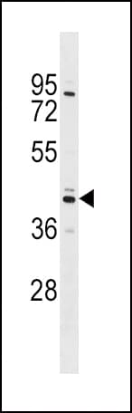 SHBG Antibody (aa69-96)