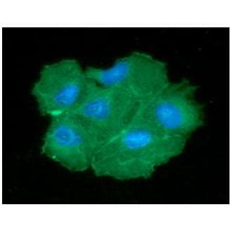PGAM2 Antibody (clone AT5A7)