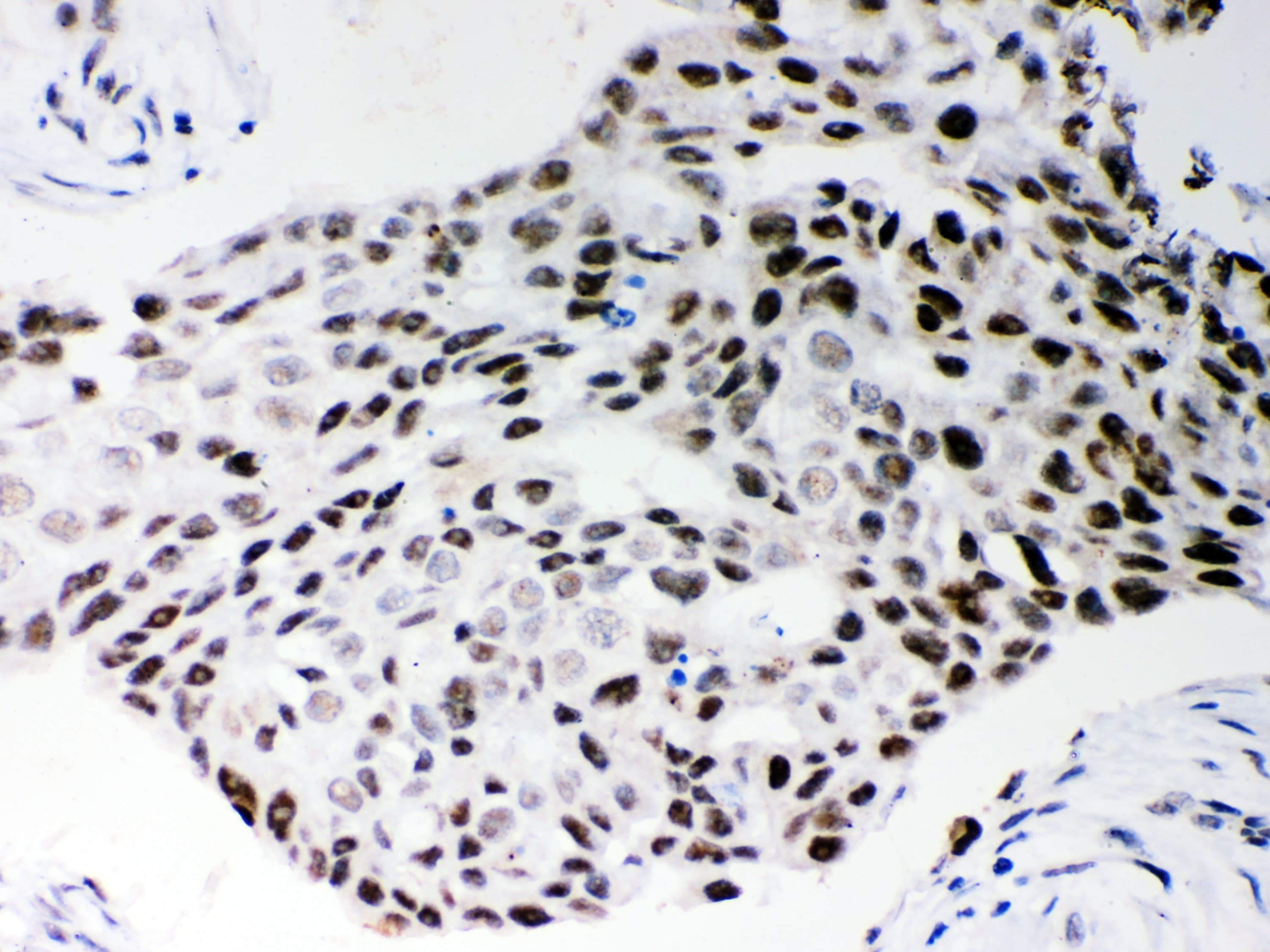 SRSF1 / SF2 Antibody (aa6-33)