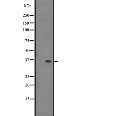 OR2S2 Antibody