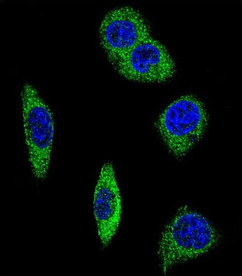 ADRA2B Antibody (aa343-369)