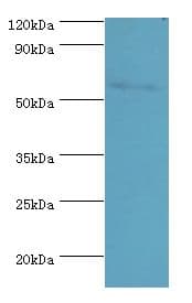 Polyclonal Rabbit anti-Human PAX7 Antibody (aa291-520, IHC, WB)